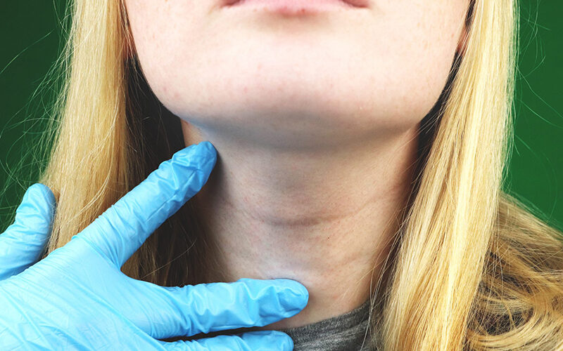 sức khỏe tuyến giáp