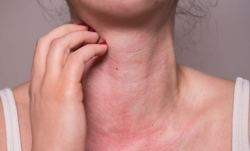 Những Người Nào Không Nên Uống Sữa Hạt?