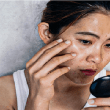 Da Xỉn Màu Là Dấu Hiệu Gì Bên Trong?