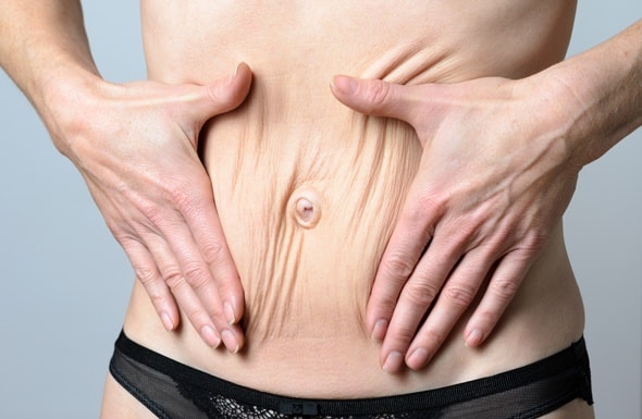 Vì Sao Không Nên Giảm Cân Quá Nhanh