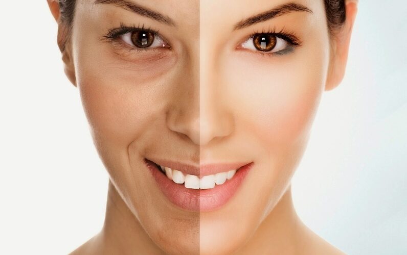 Nguyên Nhân Khiến Da Xỉn Màu Dù Chăm Sóc Kỹ