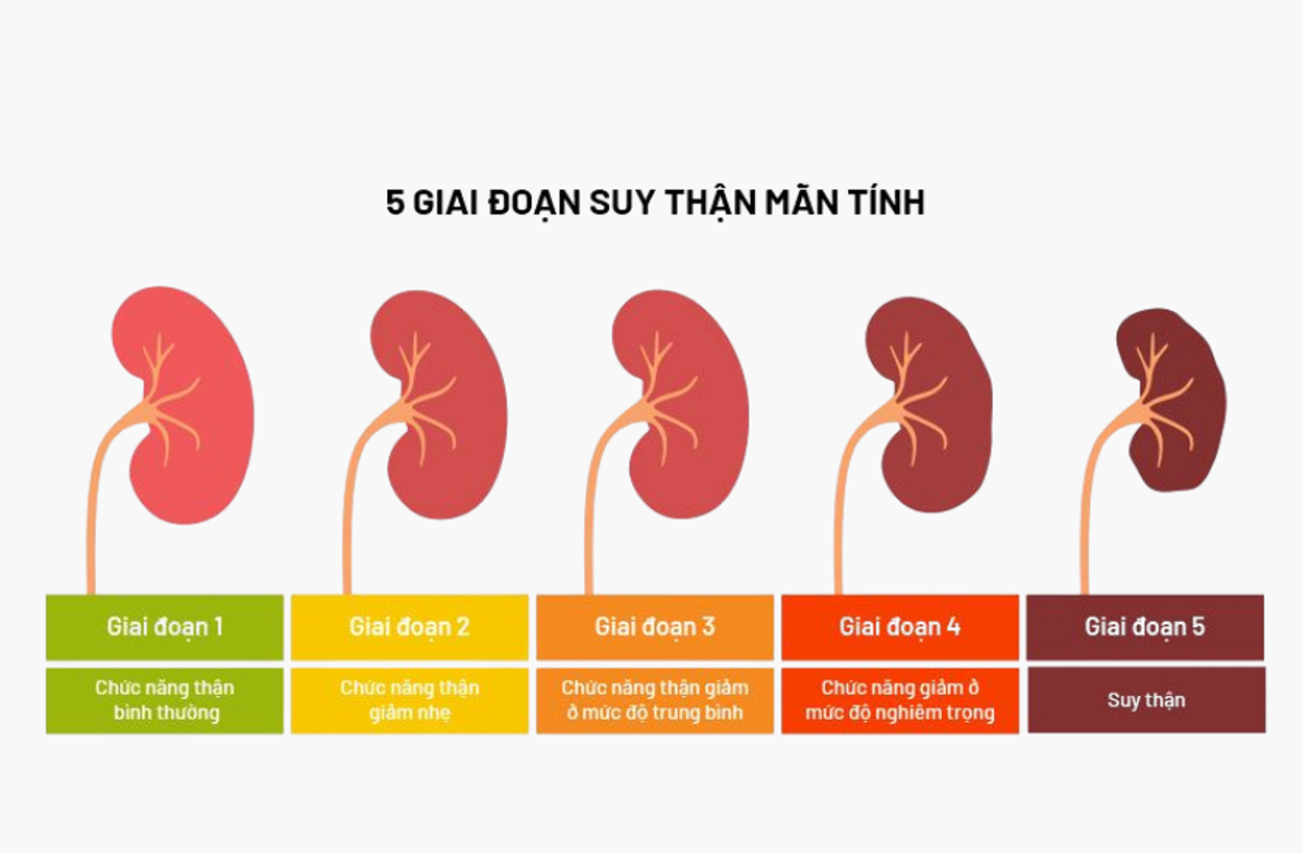 Thói Quen Xấu Gây Suy Thận Ở Người Trẻ Nên Phòng Tránh